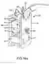 Fig. 18 - THERAPEUTIC ELECTROLYSIS DEVICE WITH REPLACEABLE IONIZER UNIT