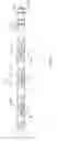 Fig. 07 - Shielded network for an active medical device implantable lead