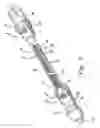 Fig. 09 - Prosthesis deployment system