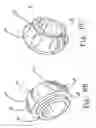 Fig. 11 - Prosthesis deployment system