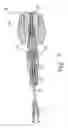 Fig. 12 - Prosthesis deployment system