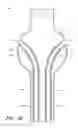 Fig. 27 - APPARATUS AND METHOD OF PLACEMENT OF A GRAFT OR GRAFT SYSTEM