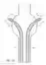 Fig. 30 - APPARATUS AND METHOD OF PLACEMENT OF A GRAFT OR GRAFT SYSTEM
