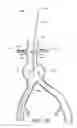 Fig. 43 - APPARATUS AND METHOD OF PLACEMENT OF A GRAFT OR GRAFT SYSTEM