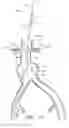 Fig. 44 - APPARATUS AND METHOD OF PLACEMENT OF A GRAFT OR GRAFT SYSTEM