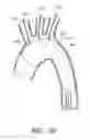 Fig. 22 - APPARATUS AND METHOD OF PLACEMENT OF A GRAFT OR GRAFT SYSTEM