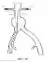 Fig. 25 - APPARATUS AND METHOD OF PLACEMENT OF A GRAFT OR GRAFT SYSTEM