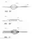 Fig. 26 - APPARATUS AND METHOD OF PLACEMENT OF A GRAFT OR GRAFT SYSTEM