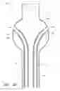 Fig. 27 - APPARATUS AND METHOD OF PLACEMENT OF A GRAFT OR GRAFT SYSTEM