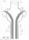 Fig. 28 - APPARATUS AND METHOD OF PLACEMENT OF A GRAFT OR GRAFT SYSTEM