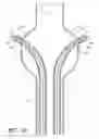 Fig. 30 - APPARATUS AND METHOD OF PLACEMENT OF A GRAFT OR GRAFT SYSTEM