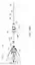 Fig. 31 - APPARATUS AND METHOD OF PLACEMENT OF A GRAFT OR GRAFT SYSTEM