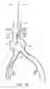 Fig. 42 - APPARATUS AND METHOD OF PLACEMENT OF A GRAFT OR GRAFT SYSTEM