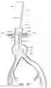 Fig. 44 - APPARATUS AND METHOD OF PLACEMENT OF A GRAFT OR GRAFT SYSTEM