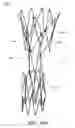 Fig. 50 - APPARATUS AND METHOD OF PLACEMENT OF A GRAFT OR GRAFT SYSTEM