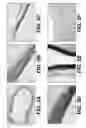 Fig. 06 - Vascular grafts derived from acellular tissue matrices