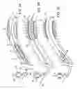 Fig. 03 - Implantable medical devices