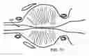 Fig. 13 - Implantable medical devices