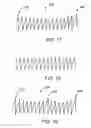 Fig. 20 - Implantable medical devices
