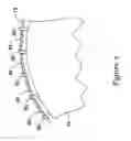 Fig. 09 - SHEATHLESS EMBOLIC PROTECTION DEVICE