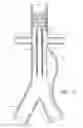 Fig. 04 - Fenestrated prosthesis