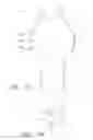 Fig. 08 - Fenestrated prosthesis