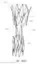 Fig. 50 - Fenestrated prosthesis