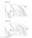 Fig. 03 - Contoured sewing ring for a prosthetic mitral heart valve