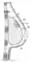 Fig. 01 - Self supporting and forming breast implant and method for forming and supporting an implant in a human body