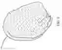 Fig. 10 - Method for manufacturing artificial implants