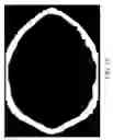 Fig. 16 - Method for manufacturing artificial implants