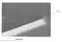 Fig. 09 - Method to reduce wedge effects in molded trigonal tips