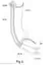 Fig. 07 - STRUCTURE OF SWIMMING GOGGLES