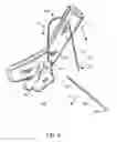 Fig. 05 - Article of manufacture and method for detachably securing two or more garment items together