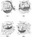 Fig. 02 - Jewelry piece or ring