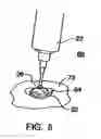 Fig. 08 - Pick for playing a stringed instrument