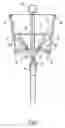 Fig. 02 - Double bow system
