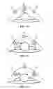Fig. 14 - Respiratory treatment delivery system