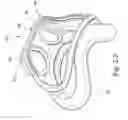 Fig. 06 - Cushion for mask system