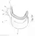 Fig. 09 - Cushion for mask system