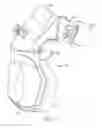 Fig. 02 - Forehead pad for respiratory mask