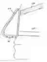 Fig. 01 - Sealing nasal devices for use while sleeping