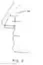 Fig. 04 - Sealing nasal devices for use while sleeping
