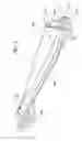 Fig. 04 - Portable Containment Device and Method