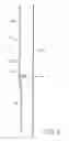 Fig. 06 - SAFETY BUCKLE FOR A WINDOW BLIND ASSEMBLY