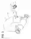 Fig. 08 - Feedthru including a ceramic based coating and a method of applying a ceramic based coating to a feedthru