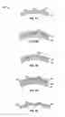 Fig. 06 - Methods of making medical devices