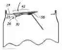 Fig. 01 - Vent opening mechanism