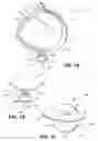 Fig. 02 - Apparatus and Methods for Securement of a Pacifier