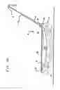 Fig. 10 - Wheel mechanism
